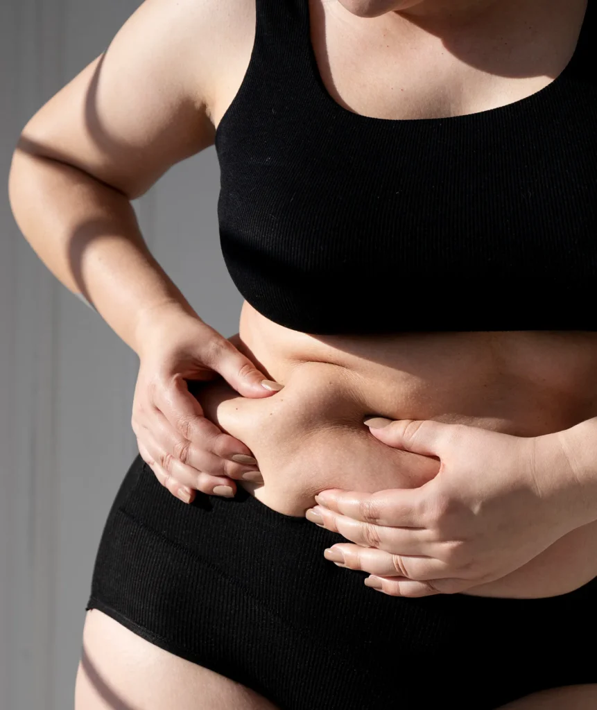 TUMMY TUCK